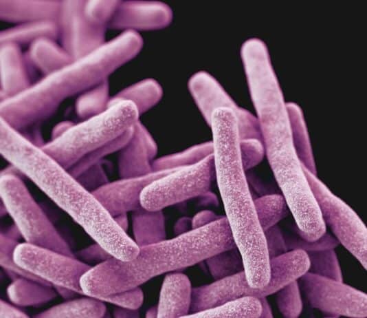 Tuberculosis Can Spread Before Symptoms Appear, Study Warns