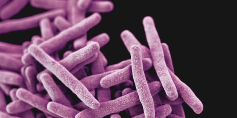 Tuberculosis Can Spread Before Symptoms Appear, Study Warns