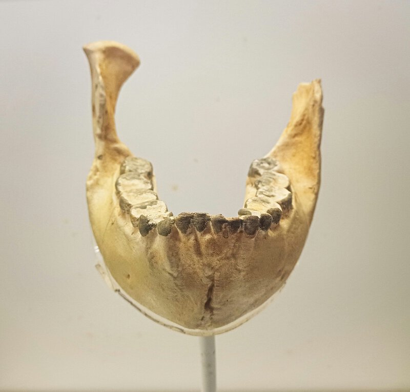 Ancient Egyptian Mummies Show Heart Disease 3,500 Years Before Modern Diets