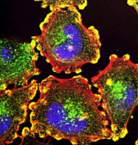 BTK Inhibitor Resistance: How Blood Cancers Bypass Even Next-Gen Drugs