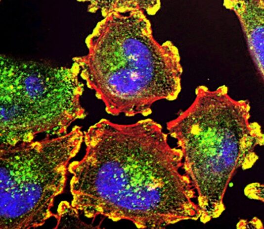 BTK Inhibitor Resistance: How Blood Cancers Bypass Even Next-Gen Drugs