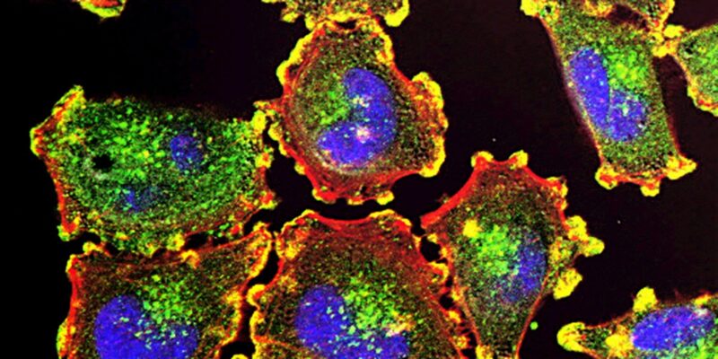 BTK Inhibitor Resistance: How Blood Cancers Bypass Even Next-Gen Drugs