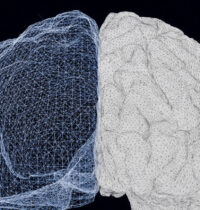 Brain Scans Reveal Two Biologically Distinct Forms of Major Depression
