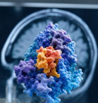 A Protein That Shields the Brain From Alzheimer’s — Even in High-Risk People