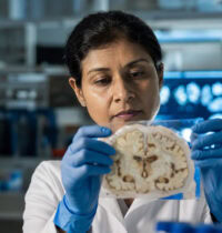 Experimental Alzheimer’s Drug Targets Tau — and Cut Symptom Risk in Half