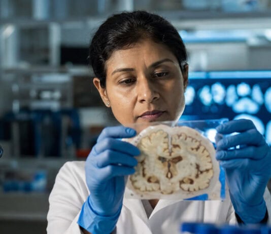 Experimental Alzheimer’s Drug Targets Tau — and Cut Symptom Risk in Half