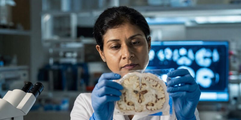 Experimental Alzheimer’s Drug Targets Tau — and Cut Symptom Risk in Half