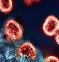 Ancient Smallpox Genomes Suggest the Virus Grew Deadlier Over Time