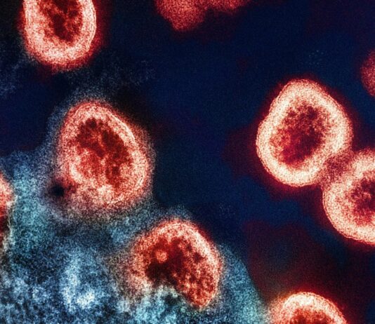 Ancient Smallpox Genomes Suggest the Virus Grew Deadlier Over Time