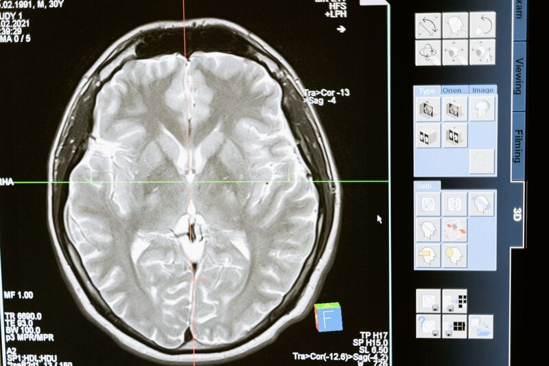 Why the Odyssey Still Resonates: What Neuroscience Reveals