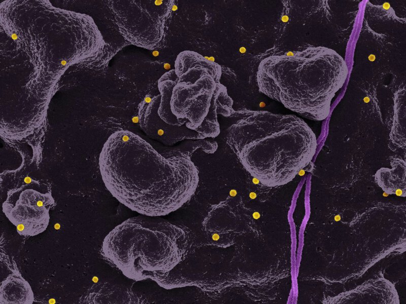 Fermented Cabbage Bacteria Bind 57% of Nanoplastics — and Double Excretion
