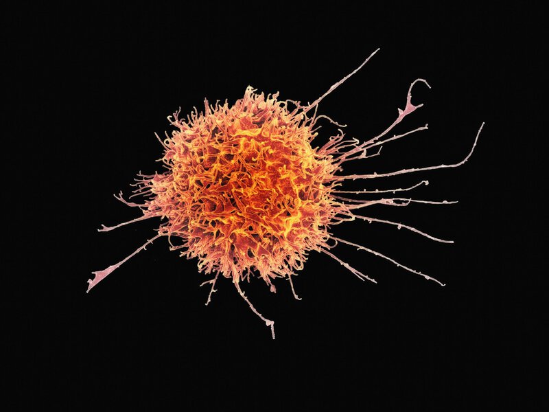 BTK Inhibitor Resistance: How Blood Cancers Bypass Even Next-Gen Drugs