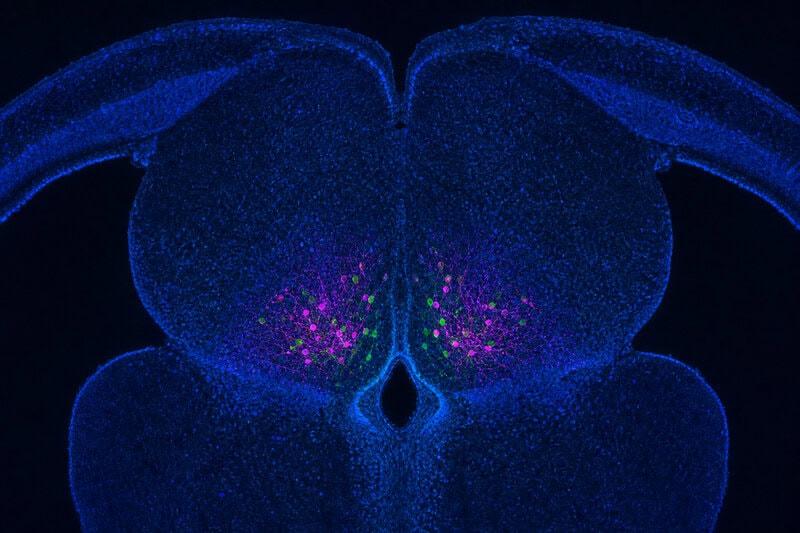 Brain Cells That Act as a Focus Switch: What Scientists Found in Mice