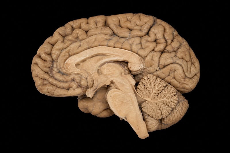 Cerebrum Is 85% of Brain Weight but Cerebellum Has 69 Billion Neurons