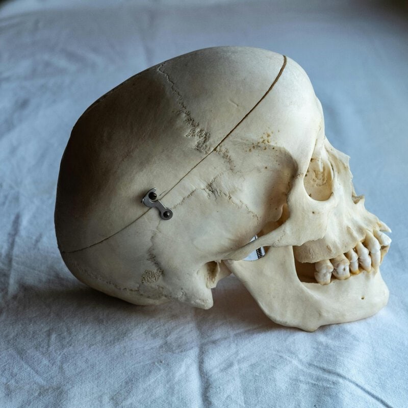 200,000-Year-Old Homo Skull Found in Spain Rewrites Iberian Prehistory