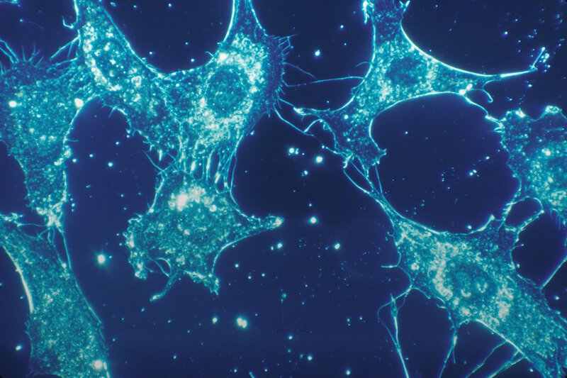 Brain Hits a Biological Phase Shift Between 50 and 75, Study Finds